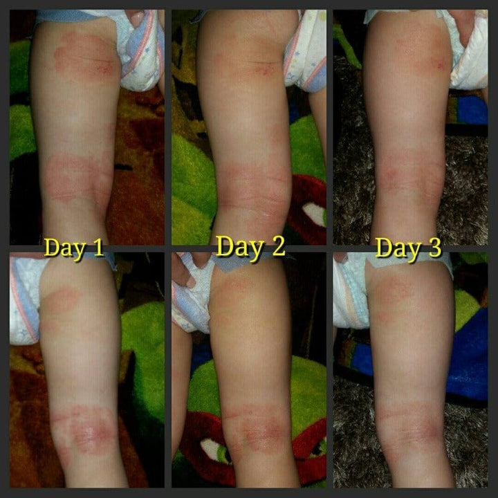 SOOTHE MY SKIN REJUVENATION CREAM: BELEBEN SIE IHRE AUSSTRAHLUNG MIT EMUÖL